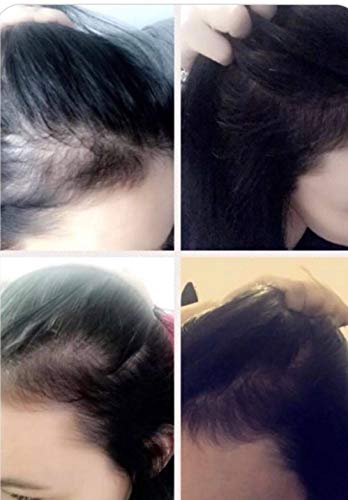 Watermans Hair Growth Shampoo, Conditioner and Elixir for Men and Women - Combo Pack 4