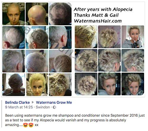 Watermans Hair Growth Shampoo, Conditioner and Elixir for Men and Women - Combo Pack 3