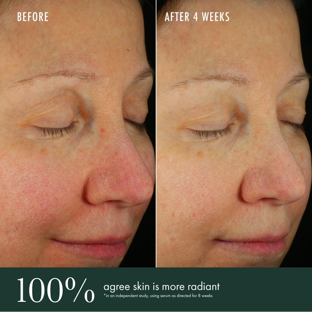 RéVive Brightening Serum - Skincare with Vitamin C, Niacinamide and Bio-Renewal Peptide - Evens Skin Tone, Refines Skin Texture and Reduces Wrinkles 4