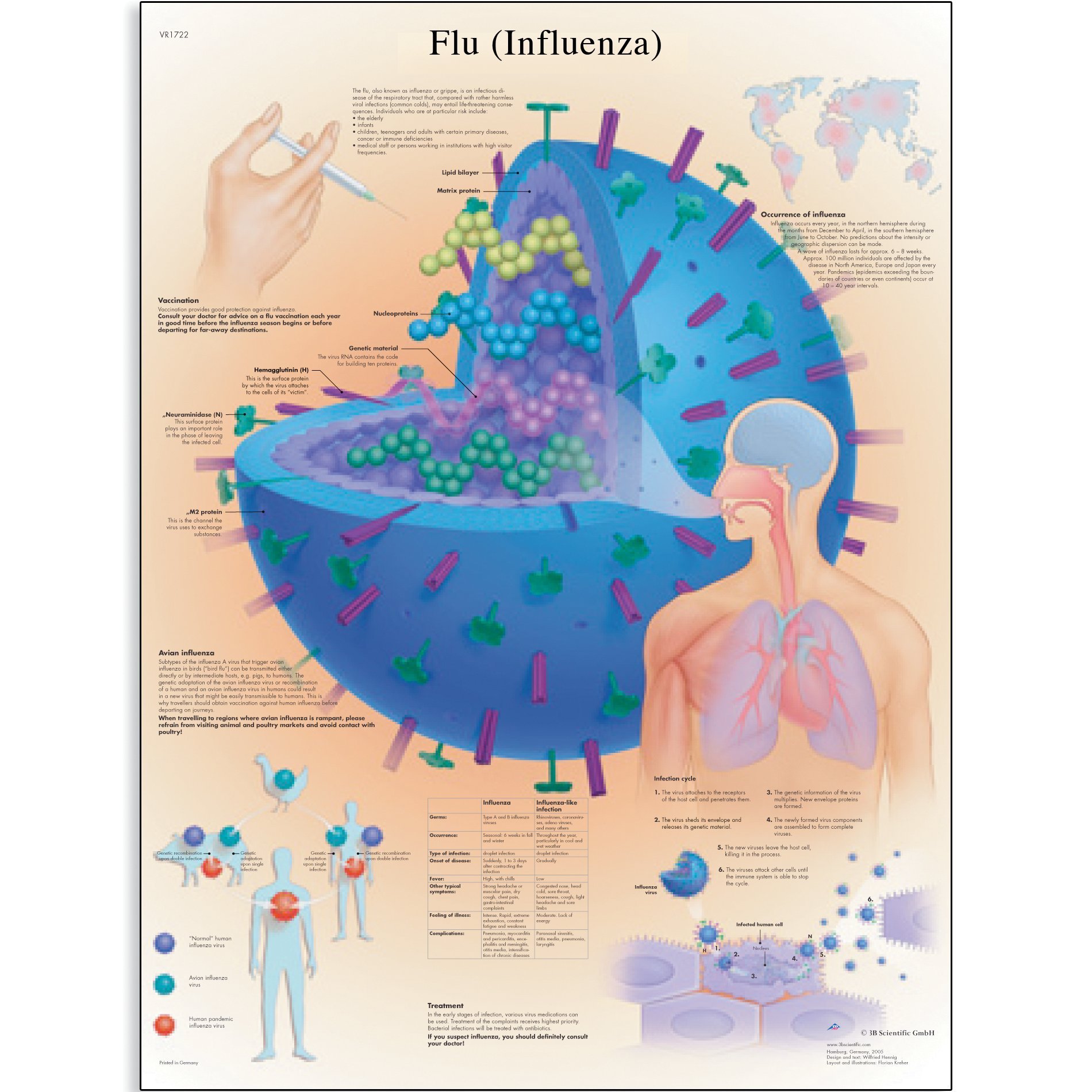 3B Scientific VR1722UU Glossy Paper Flu (Influenza) Anatomical Chart, Poster Size 20" Width x 26" Height 1
